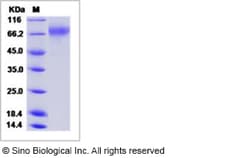 Sino Biological Influenza A H3N2 (A/Hong Kong/CUHK31987/2011) Hemagglutinin