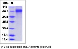 Sino Biological Influenza A H3N2 (A/Sydney/5/1997) Hemagglutinin / HA Protein