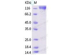 Sino Biological SARS-CoV Spike/S1 Protein (S1 Subunit, mFc Tag) 100ug,