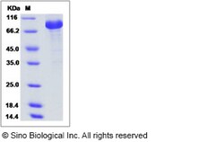 Sino Biological SARS-CoV Spike/S1 Protein (S1 Subunit, His Tag) 100ug,