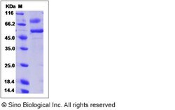 Sino Biological SARS-CoV Spike/RBD Protein (RBD, rFc Tag), Quantity: Each