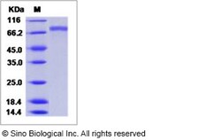Sino Biological Influenza A H3N2 (A/Victoria/208/2009) Hemagglutinin /