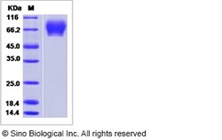 Sino Biological Influenza A H3N2 (A/Guangdong-Luohu/1256/2009) Hemagglutinin