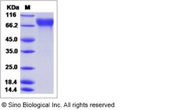 Sino Biological Influenza A H3N2 (A/Babol/36/2005) Hemagglutinin / HA Protein