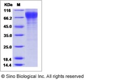 Sino Biological Influenza A H3N2 (A/Babol/36/2005) Hemagglutinin / HA0