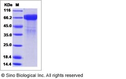 Sino Biological Influenza B (B/Yamagata/16/1988) Hemagglutinin / HA Protein