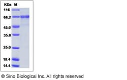 Sino Biological Influenza A H5N1 (A/chicken/VietNam/NCVD-016/2008) Hemagglutinin