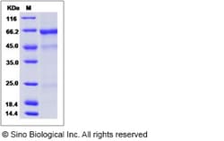 Sino Biological Influenza A H5N1 (A/barnswallow/HongKong/D10-1161/2010)