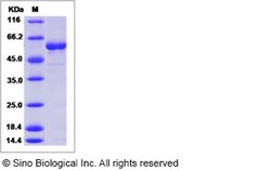 Sino Biological Influenza A H5N8 (A/turkey/Ireland/1378/1983) Hemagglutinin