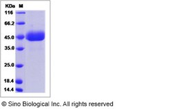 Sino Biological Influenza A H5N8 (A/turkey/Ireland/1378/1983) Hemagglutinin