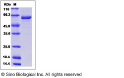 Sino Biological Influenza A H5N9 (A/chicken/Italy/22A/1998) Hemagglutinin