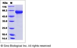 Sino Biological Influenza A H6N2 (A/duck/Shantou/83/2000) Hemagglutinin