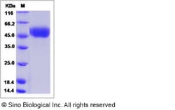 Sino Biological Influenza A H6N2 (A/duck/Shantou/83/2000) Hemagglutinin