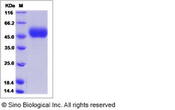 Sino Biological Influenza A H6N5 (A/shearwater/Australia/1/1973) Hemagglutinin