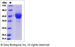 Sino Biological Influenza A H6N8 (A/mallard/Ohio/217/1998) Hemagglutinin