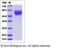 Sino Biological Influenza A H9N2 (A/Hong Kong/35820/2009) Hemagglutinin