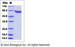 Sino Biological Influenza A H9N2 (A/Hong Kong/3239/2008) Hemagglutinin