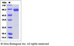 Sino Biological Influenza A H10N3 (A/mallard/Minnesota/Sg-00194/2007) Hemagglutinin