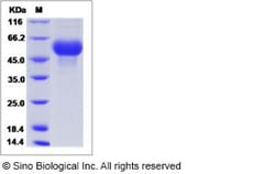 Sino Biological Influenza A H12N3 (A/bar headed goose/Mongolia/143/2005)