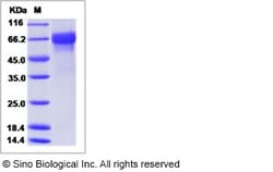 Sino Biological Influenza B (B/Massachusetts/03/2010) Hemagglutinin / HA
