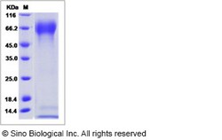 Sino Biological Influenza B (B/Massachusetts/03/2010) Hemagglutinin Protein