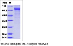 Sino Biological Influenza B (B/Massachusetts/03/2010) Hemagglutinin / HA0