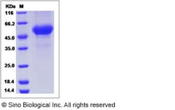 Sino Biological Influenza A H14N5 (A/mallard/Astrakhan/263/1982) Hemagglutinin