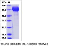 Sino Biological Influenza A H7N7 (A/Netherlands/219/2003) Neuraminidase