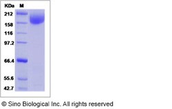Sino Biological HIV-1 gp140 Protein (group M, subtype A, strain 92UG037.1)