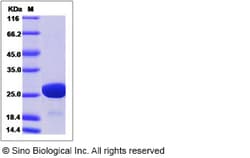 Sino Biological HIV-1 p24 Protein (group M, subtype B, strain HXB2) (His