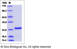 Sino Biological HIV-1 p24 protein (group N, strain 06CM-U14296) (His Tag)