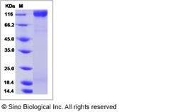 Sino Biological HIV-1 gp160 Protein (gp120 subunit) (group N, strain 06CM-U14296)