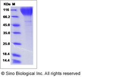 Sino Biological HIV-1 gp120 Protein (group P, strain RBF168) (His Tag)