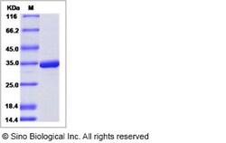 Sino Biological Dengue virus DENV-2 (strain New Guinea C) NS5 (methyltransferase