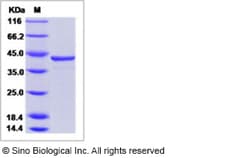 Sino Biological Hepatitis C virus (HCV-1a) NS3 protease / helicase immunodominant