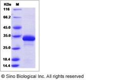 Sino Biological Recombinant P. falciparum pfHPRT Protein (His Tag), Quantity: