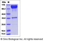 Sino Biological Ebola virus EBOV (subtype Zaire, strain Mayinga 1976) Glycoprotein