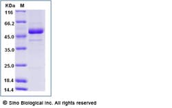 Sino Biological Rift Valley fever virus (RVFV) (strain MP12) glycoprotein