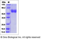 Sino Biological West Nile Virus (WNV) (lineage 1, strain NY99) NS1 Protein