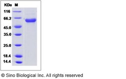 Sino Biological Influenza A H10N8 (A/Jiangxi-Donghu/346/2013) Hemagglutinin