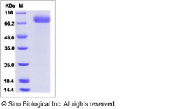 Sino Biological Ebola virus EBOV (subtype Bundibugyo, strain Uganda 2007)