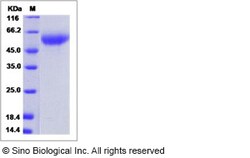 Sino Biological Influenza A H5N1 (A/chicken/Jilin/9/2004) Hemagglutinin