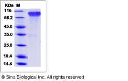 Sino Biological Epstein-Barr virus (Herpesvirus 4) EBV Glycoprotein gp350