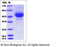 Sino Biological Influenza A H5N8 (A/broiler duck/Korea/Buan2/2014) Hemagglutinin