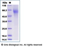 Sino Biological Influenza B (B/Victoria/504/2000) Hemagglutinin / HA1 Protein