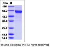 Sino Biological Influenza A H1N1 (A/NewJersey/8/1976) Hemagglutinin / HA