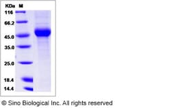 Sino Biological Influenza A H1N1 (A/NewJersey/8/1976) Hemagglutinin / HA1