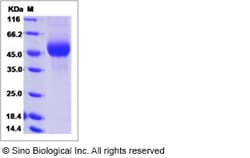 Sino Biological Influenza A H1N1 (A/swine/Belgium/1/1998) Hemagglutinin