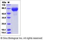 Sino Biological Influenza A H3N2 (A/Victoria/3/1975) Hemagglutinin / HA1