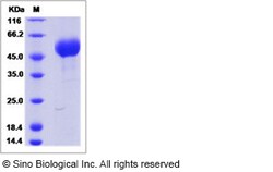 Sino Biological Influenza A H6N2 (A/chicken/Guangdong/C273/2011) Hemagglutinin